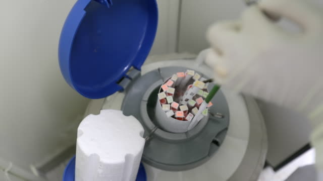 液氮罐凍存細(xì)胞 液氮罐凍存細(xì)胞